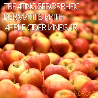 Treating Seborrheic Dermatitis with Apple Cider Vinegar Cover Photo
