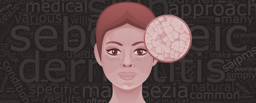 What is Seborrheic Dermatitis Cover Photo